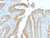 IHC testing of FFPE human colon tissue with recombinant Cytokeratin 19 antibody (clone rKRT19/799). Required HIER: boil tissue sections in pH 9 10mM Tris with 1mM EDTA for 10-20 min followed by cooling at RT for 20 min.