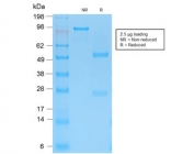 SDS-PAGE analysis of purified, BSA-free recombinant Cytokeratin 15 antibody (clone KRT15/2103R) as confirmation of integrity and purity.