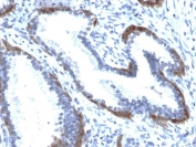 IHC testing of FFPE human prostate tissue with recombinant Cytokeratin 15 antibody (clone KRT15/2103R). Required HIER: boil tissue sections in pH6, 10mM citrate buffer, for 10-20 min followed by cooling at RT for 20 min.