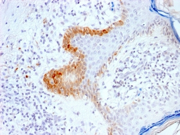 IHC testing of FFPE human skin with recombinant Cytokeratin 15 antibody (clone KRT15/2103R). Required HIER: boil tissue sections in pH6, 10mM citrate buffer, for 10-20 min followed by cooling at RT for 20 min.~