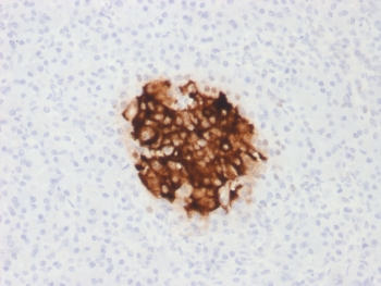 IHC testing of FFPE human pancreas with recombinant Insulin antibody (clone rIRDN/805). Required HIER: boil tissue sections in pH6, 10mM citrate buffer, for 10-20 min followed by cooling at RT for 20 min.~