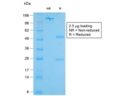 SDS-PAGE analysis of purified, BSA-free recombinant KRT19 antibody (clone KRT19/1959R) as confirmation of integrity and purity.