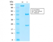 SDS-PAGE analysis of purified, BSA-free recombinant EpCAM antibody (clone rEGP40/1110) as confirmation of integrity and purity.
