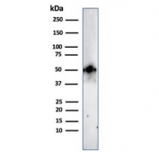 Western blot testing of human HeLa cell lysate with recombinant FOXA1 antibody (clone FOXA1/2230R). Predicted molecular weight: ~49 kDa.