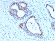 IHC testing of FFPE human tonsil tissue with recombinant FOXA1 antibody (clone FOXA1/2230R). HIER: boil sections in 10mM Tris with 1mM EDTA, pH9 for 10-20 min followed by cooling at RT for 20 min.