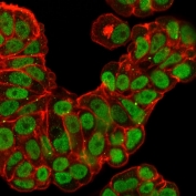 Immunofluorescent staining of PFA-fixed human MCF7 cells with recombinant FOXA1 antibody (clone FOXA1/2230R, green) and Phalloiden (red).