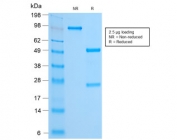 SDS-PAGE analysis of purified, BSA-free recombinant FOXA1 antibody (clone FOXA1/2230R) as confirmation of integrity and purity.