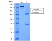 SDS-PAGE analysis of purified, BSA-free recombinant FOXA1 antibody (clone rFOXA1/1515) as confirmation of integrity and purity.