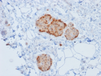 IHC testing of human pancreas tissue with recombinant CHGA antibody (rCHGA/777). Required HIER: boil tissue sections in 10mM citrate buffer, pH 6, for 10-20 min followed by cooling at RT for 20 min.~