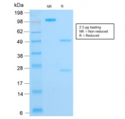 SDS-PAGE analysis of purified, BSA-free Cytokeratin 16 antibody (clone KRT16/1714) as confirmation of integrity and purity.