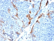 IHC testing of FFPE human tonsil with Cytokeratin 16 antibody (clone KRT16/1714). Required HIER: boil tissue sections in pH6, 10mM citrate buffer, for 10-20 min followed by cooling at RT for 20 min.