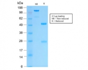 SDS-PAGE analysis of purified, BSA-free recombinant Keratin 16 antibody (clone KRT16/2043R) as confirmation of integrity and purity.