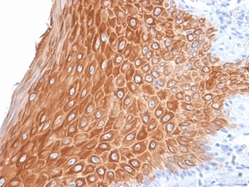 IHC testing of FFPE human skin with recombinant Keratin 16 antibody (clone KRT16/2043R). Required HIER: boil tissue sections in pH6, 10mM citrate buffer, for 10-20 min followed by cooling at RT for 20 min.~