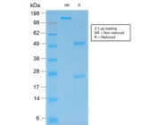 SDS-PAGE analysis of purified, BSA-free recombinant MMP9 antibody (clone rMMP9/1769) as confirmation of integrity and purity.