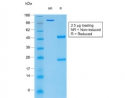 SDS-PAGE analysis of purified, BSA-free recombinant TG antibody (clone rTGB24) as confirmation of integrity and purity.
