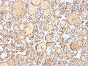 IHC: Formalin-fixed, paraffin-embedded human thyroid gland stained with recombinant TG antibody (clone r6E1). Required HIER: boil tissue sections in pH 9 10mM Tris with 1mM EDTA for 10-20 min followed by cooling at RT for 20 min.
