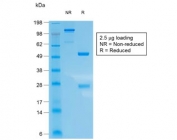 SDS-PAGE analysis of purified, BSA-free recombinant CK10 antibody (clone KRT10/1948R) as confirmation of integrity and purity.