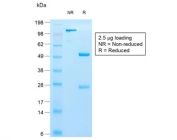 SDS-PAGE analysis of purified, BSA-free recombinant Cytokeratin 10 antibody (clone KRT10/1990R) as confirmation of integrity and purity.