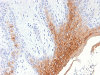 IHC testing of FFPE human skin with recombinant Cytokeratin 10 antibody (clone KRT10/1990R). Required HIER: boil tissue sections in pH6, 10mM citrate buffer, for 10-20 min followed by cooling at RT for 20 min.~