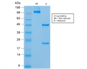 SDS-PAGE analysis of purified, BSA-free recombinant CD146 antibody (clone rMUC18/1130) as confirmation of integrity and purity.