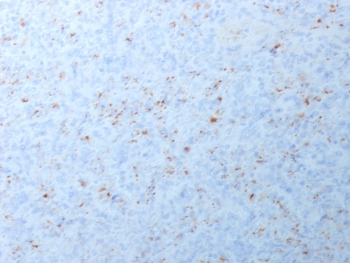 IHC testing of FFPE human spleen with recombinant MMP3 antibody (clone MMP3/1994R). Required HIER: boil tissue sections in pH6, 10mM citrate buffer, for 10-20 min followed by cooling at RT for 20 min.~