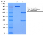SDS-PAGE analysis of purified, BSA-free recombinant MMP3 antibody (clone rMMP3/1730) as confirmation of integrity and purity.