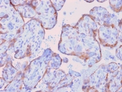 IHC testing of FFPE human placenta with recombinant MMP3 antibody (clone rMMP3/1730). Required HIER: boil tissue sections in pH 9 10mM Tris with 1mM EDTA for 10-20 min followed by cooling at RT for 20 min.