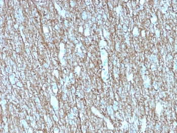 IHC testing of FFPE human brain with recombinant Neurofilament antibody (clone rNF421). Required HIER: boil tissue sections in 10mM citrate buffer, pH6, for 10-20 min followed by cooling at RT for 20 min.~