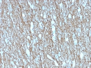 IHC testing of FFPE human brain with recombinant Neurofilament antibody (clone rNF421). Required HIER: boil tissue sections in 10mM citrate buffer, pH6, for 10-20 min followed by cooling at RT for 20 min.