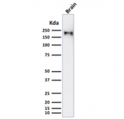 Western blot testing of human brain lysate with recombinant Neurofilament antibody (clone rNF421).