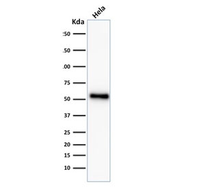 Western blot testing of human HeLa cell lysate with recombinant p53 antibody (clone TP53/2092R).~