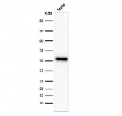 Western blot testing of human HeLa cell lysate with recombinant p53 antibody (clone TP53/2092R).