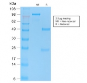 SDS-PAGE analysis of purified, BSA-free p53 antibody (clone TP53/2092R) as confirmation of integrity and purity.