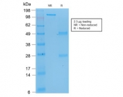 SDS-PAGE analysis of purified, BSA-free recombinant TP53 antibody (clone rBP53-12) as confirmation of integrity and purity.