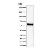 Western blot testing of human HeLa cell lysate with recombinant TP53 antibody (clone rBP53-12). Expetected molecular weight ~53 kDa.