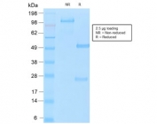 SDS-PAGE analysis of purified, BSA-free recombinant MUC16 antibody (clone OCA125/2349R) as confirmation of integrity and purity.