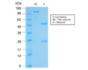 SDS-PAGE analysis of purified, BSA-free recombinant Biotin antibody (clone BTN/2032R) as confirmation of integrity and purity.