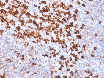 IHC: Formalin-fixed, paraffin-embedded human tonsil stained with biotinylated Kappa Light Chain Ab probe followed by anti-Biotin antibody (clone BTN/2032R). No special pretreatment is required for the immunohistochemical staining of formalin-fixed, paraffin-embedded tissues.~