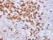 IHC: Formalin-fixed, paraffin-embedded human tonsil stained with biotinylated Kappa Light Chain Ab probe followed by anti-Biotin antibody (clone BTN/2032R). No special pretreatment is required for the immunohistochemical staining of formalin-fixed, paraffin-embedded tissues.