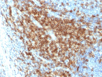 IHC testing of FFPE human tonsil with recombinant CD43 antibody (clone SPN/2049R). Required HIER: boil tissue sections in pH 9 10mM Tris with 1mM EDTA for 10-20 min followed by cooling at RT for 20 min.~