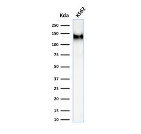 Western blot testing of human K562 cell lysate with recombinant CD43 antibody (clone rSPN/1094). Expected molecular weight: 45-135 kDa depending on glycosylation level.