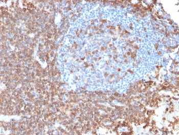 IHC testing of FFPE human lymph node with recombinant CD43 antibody (clone rSPN/839). Required HIER: boil tissue sections in pH 9 10mM Tris with 1mM EDTA for 10-20 min followed by cooling at RT for 20 min.~