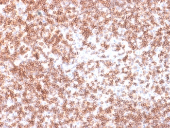 IHC testing of recombinant CD45 antibody and FFPE human lymph node (clone PTPRC/1975R). Required HIER: boil tissue sections in 10mM citrate buffer, pH 6, for 10-20 min followed by cooling at RT for 20 min.~