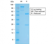 SDS-PAGE analysis of purified, BSA-free recombinant Tyrosinase antibody (clone TYR/2024R) as confirmation of integrity and purity.