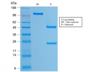 SDS-PAGE analysis of purified, BSA-free recombinant HPV16 L1 antibody (clone rHPV16L1/1058) as confirmation of integrity and purity.