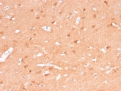IHC staining of FFPE human cerebellum tissue with recombinant PGP9.5 antibody (clone rUCHL1/775). Required HIER: boil tissue sections in pH 9 10mM Tris with 1mM EDTA for 10-20 min followed by cooling at RT for 20 min.