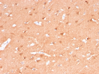 IHC staining of FFPE human cerebellum tissue with recombinant PGP9.5 antibody (clone rUCHL1/775). Required HIER: boil tissue sections in pH 9 10mM Tris with 1mM EDTA for 10-20 min followed by cooling at RT for 20 min.~