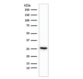 Western blot testing of human brain lysate with recombinant PGP9.5 antibody (clone rUCHL1/775). Predicted molecular weight ~25 kDa.