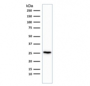 Western blot testing of human brain lysate with recombinant PGP9.5 antibody (clone rUCHL1/775). Predicted molecular weight ~25 kDa.