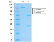 SDS-PAGE analysis of purified, BSA-free recombinant PGP9.5 antibody (clone rUCHL1/775) as confirmation of integrity and purity.